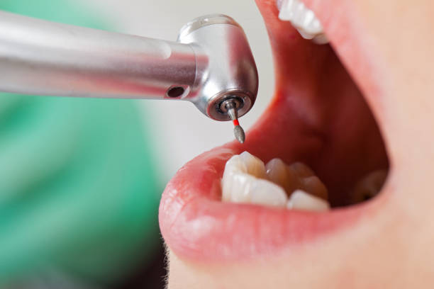 Best Emergency Treatment for Toothache in Fritz Creek, AK